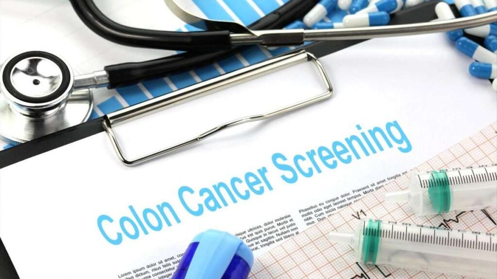 Benefits of Early Colon Cancer Screening
