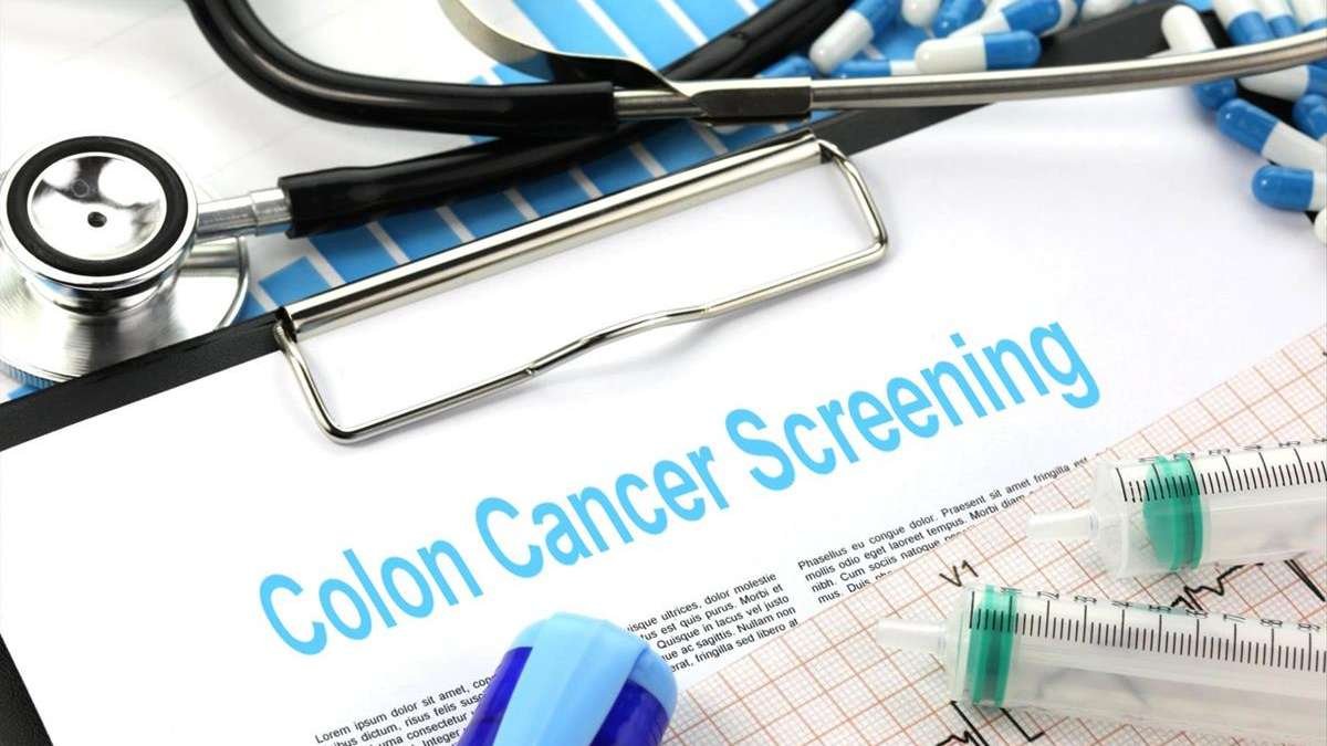 Benefits of Early Colon Cancer Screening