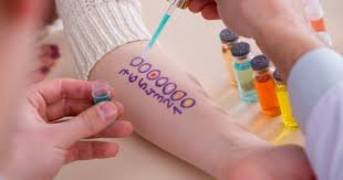 Understanding the Different Types of Allergy Testing Available