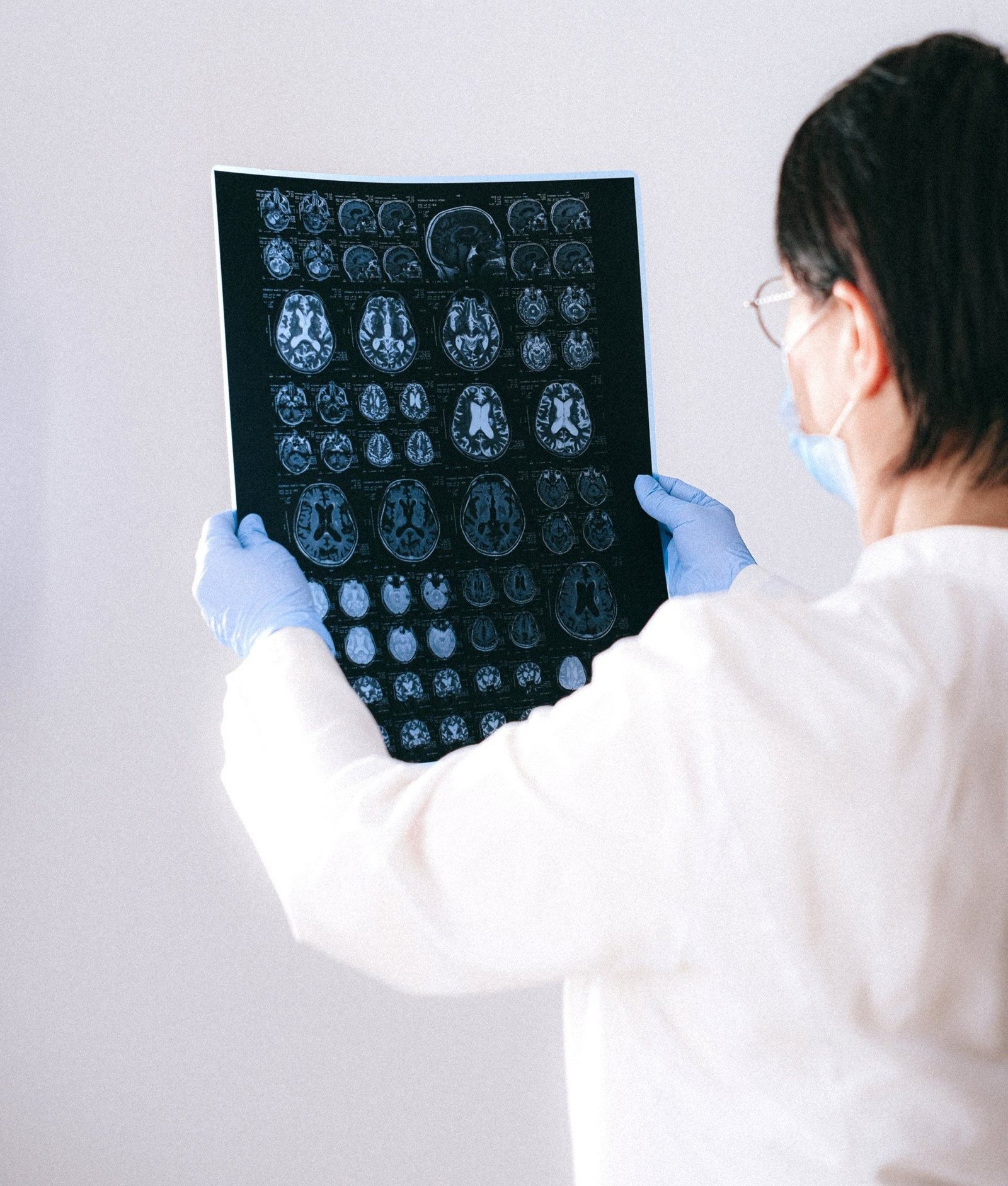 The Role of Neurological Surgeons in Treating Brain Tumors