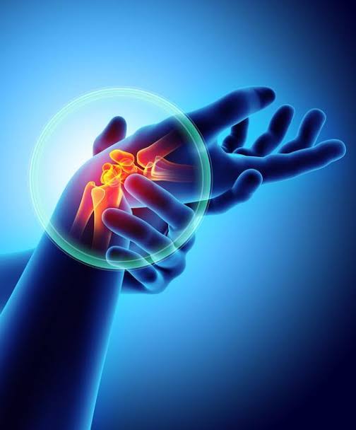 Exploring Available Arthritis Treatment Options