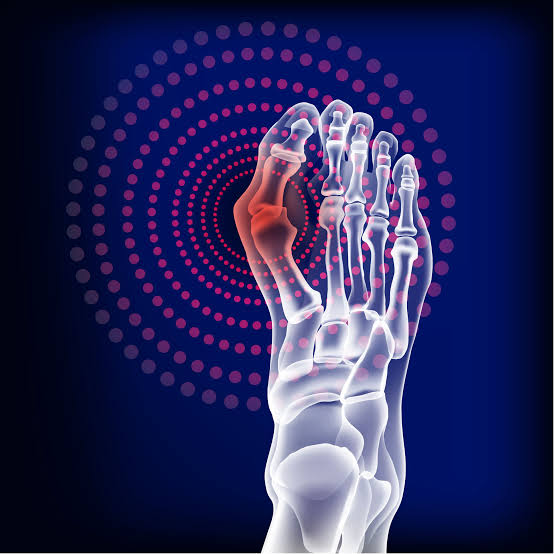 Exploring Treatment Options for Arthritis