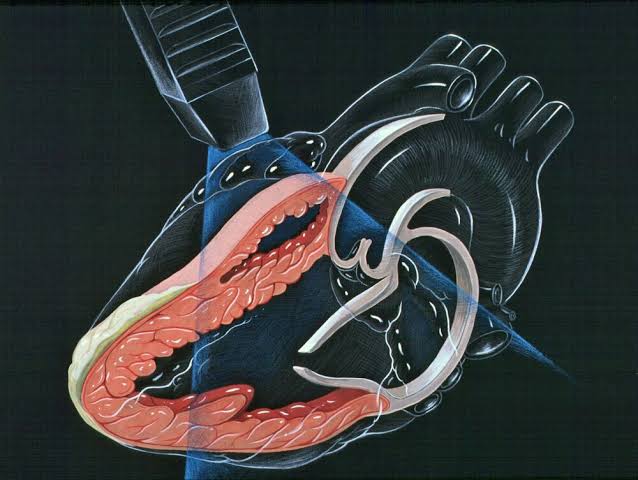 How Cardiologists Diagnose Common Heart Conditions