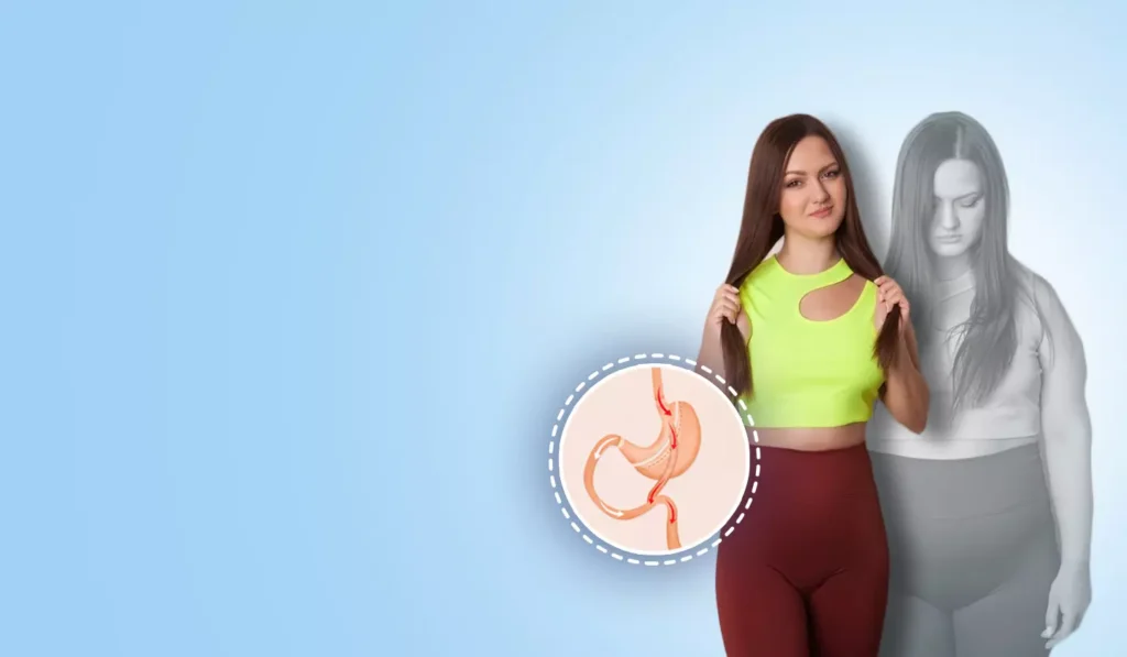Understanding the Long-Term Benefits of Weight Loss Surgery